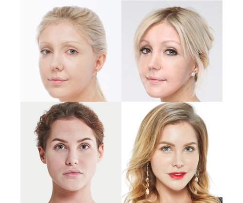 Face plastic surgery