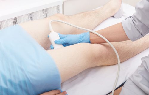 Vessels Ultrasound 1149890324